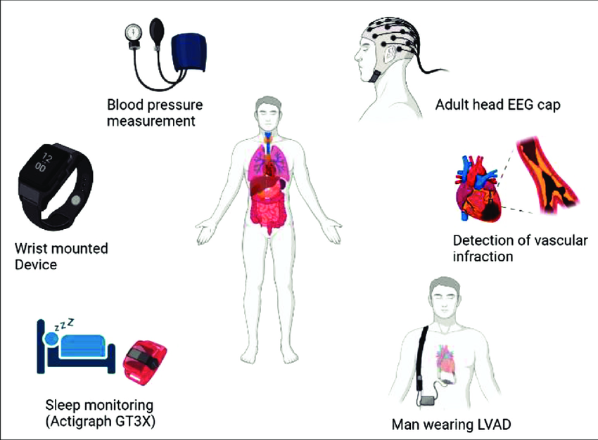 wearable sensors for panic attack monitoring